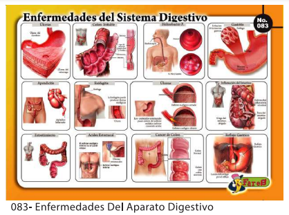 LAMINAS EDUCATIVAS ENFERMEDADES DEL APARATO DIGESTIVO