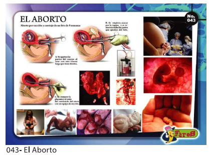 [F43] LAMINAS EDUCATIVAS EL ABORTO