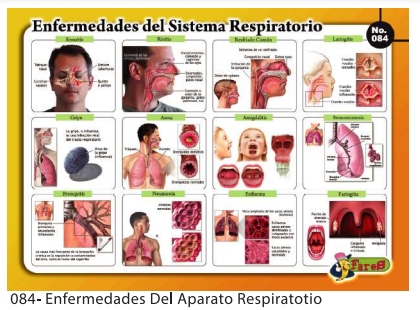 [F84] LAMINAS EDUCATIVAS ENFERMEDADES DEL APARATO RESPIRATORIO
