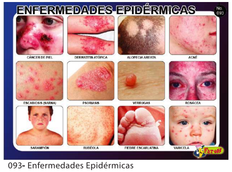 [F93] LAMINAS EDUCATIVAS ENFERMEDADES EPIDERMICAS