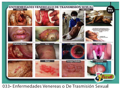 [F33] LAMINAS EDUCATIVAS ENFERMEDADES VENEREAS O DE TRANSMISION SEXUAL